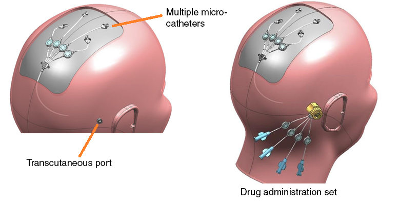 Drug infusion and administration