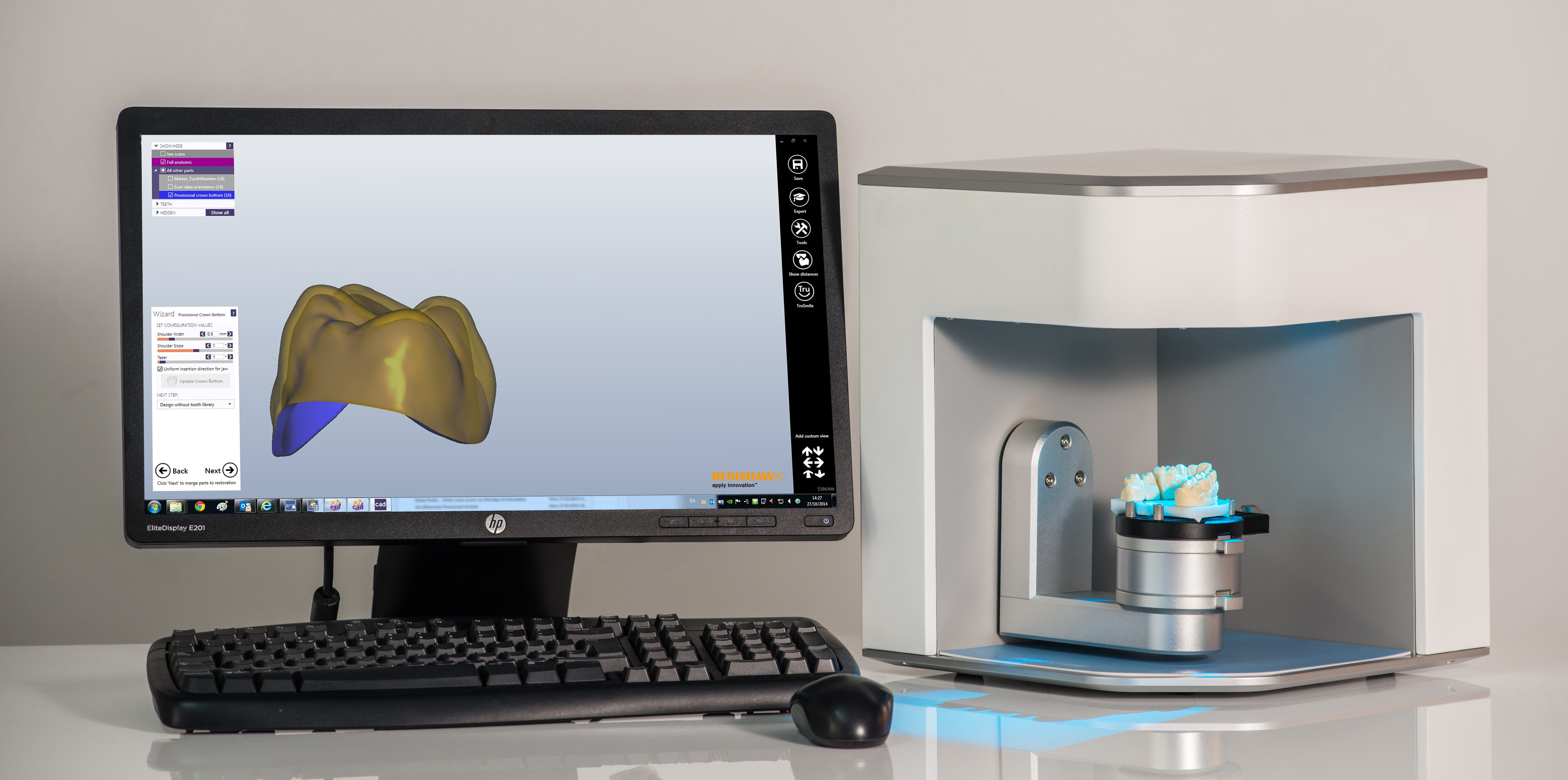 Escáner DS30 acoplado al software Renishaw Dental Studio (RDS) para diseño