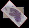 Tintado correlacionado e imágenes Raman de un corte micrótomo esofágico